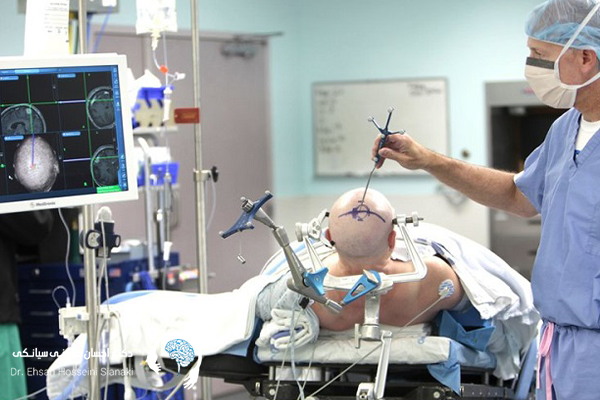 گفتاردرمانی در بیماران مبتلا به تومور مغزی